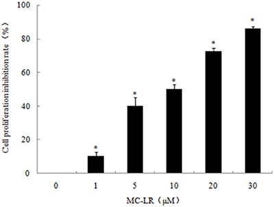 Novel Role of ER Stress and Autophagy in Microcystin-LR Induced Apoptosis in Chinese Hamster Ovary Cells